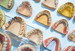 several plaster molds with different types of dentures on them