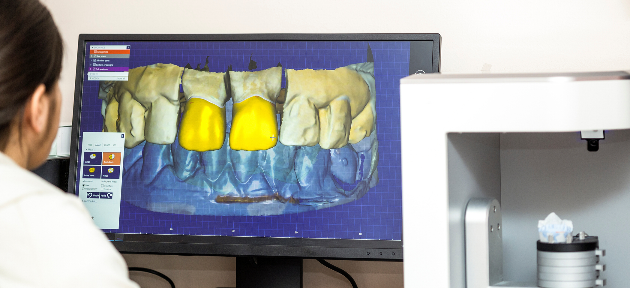 Midlothian dentist looking at render of teeth in jawbone