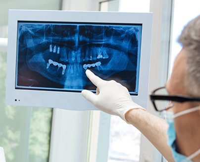 Dentist pointing to a digital dental X-ray