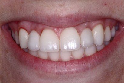 Smile Gallery | Long Family Dental