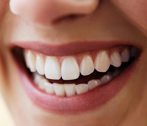 Healthy smile thanks to dental care to prevent gum disease