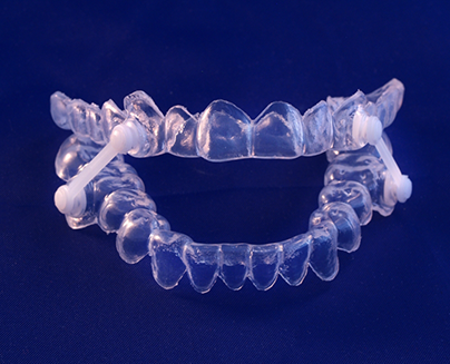 Close-up of sleep apnea oral appliance on blue surface